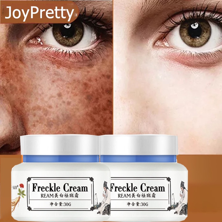 Melasma Removal Cream 100 Effective Melasma Removal CreamAntiMelasma Cream Face Cream