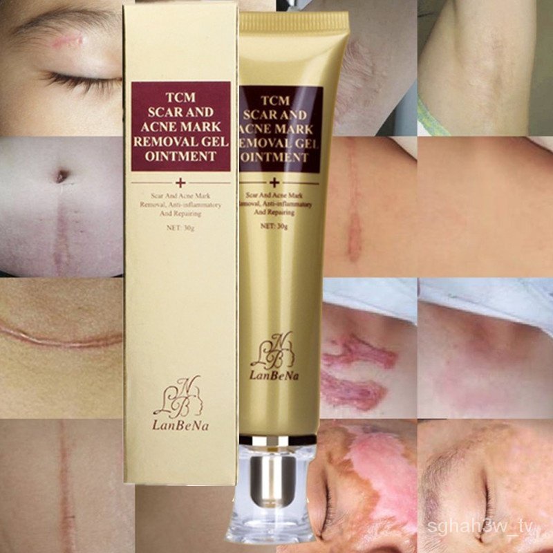 Maternity Skin Body Repair Cream Stretch Marks Remove Scar HWKW ...