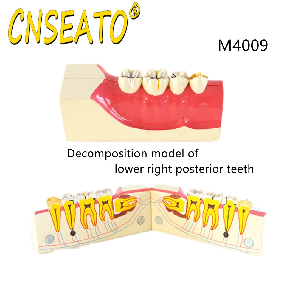 CNSEATO Dental Study Model Right Lower Tooth Decomposition Model ...