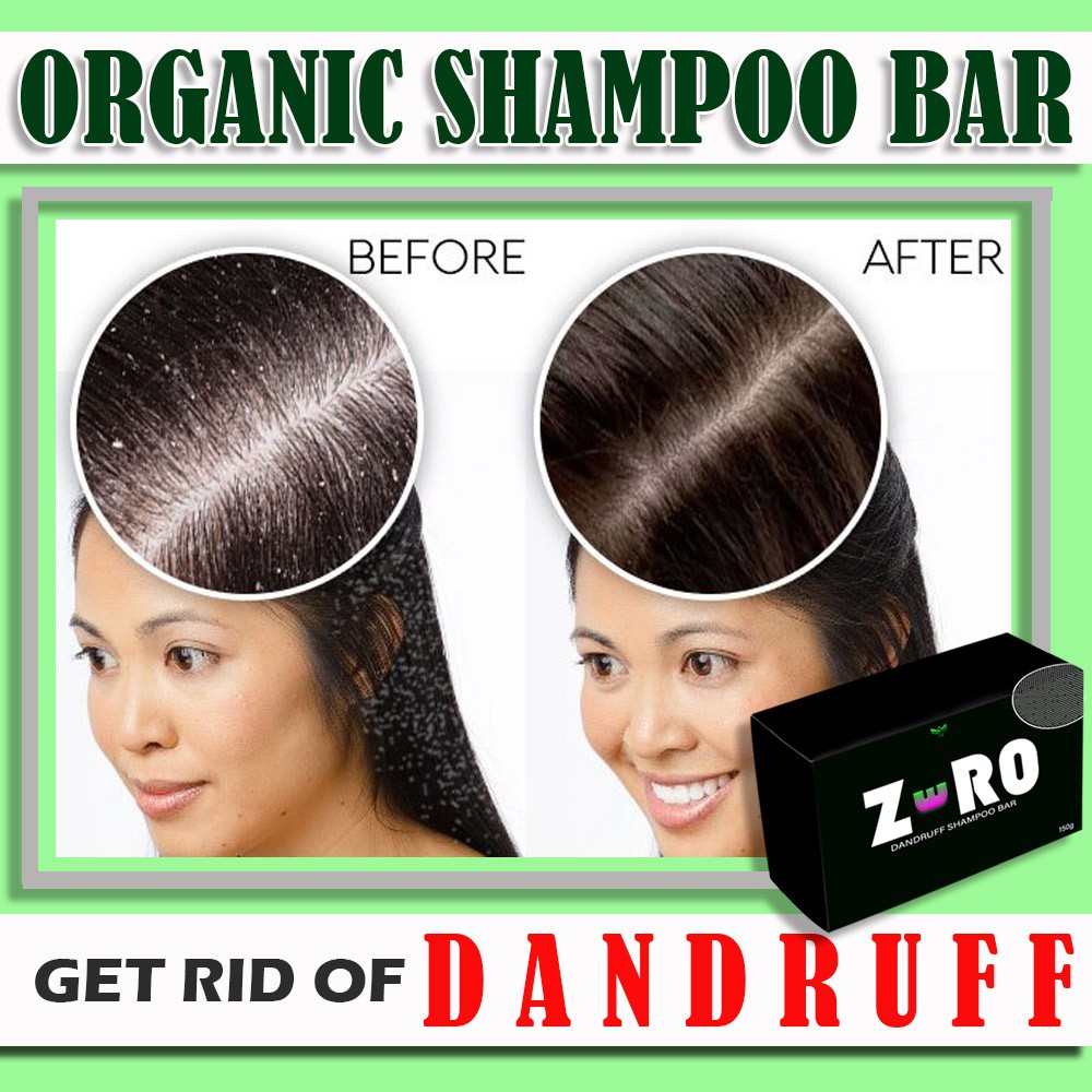 ZERO dandruff remover shampoo bar (For heavy dandruff, Anti dandruff