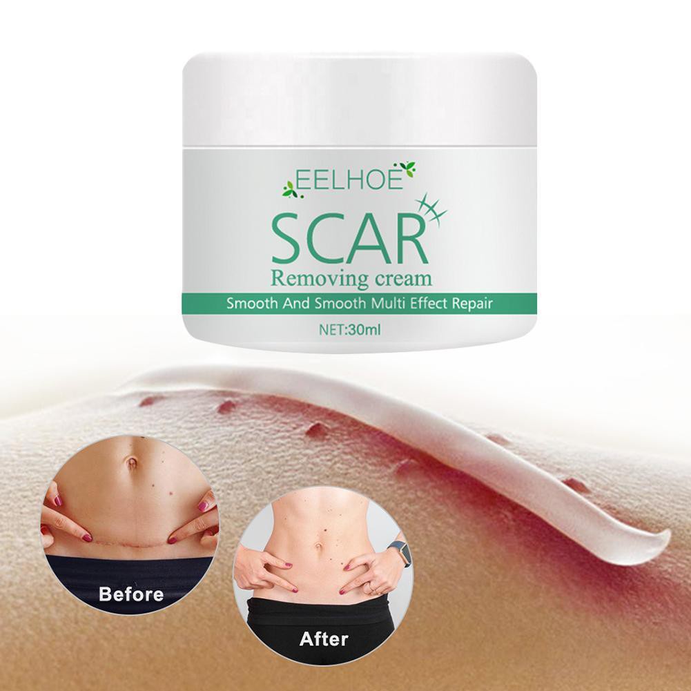 №EELHOE Scar Removal Cream For Old Scars Stretch Mark Gel Spots U2A0