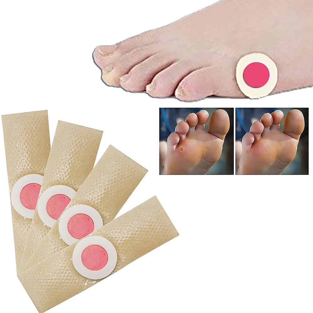 24PCS Medical Corn Plaster Foot Corn Removal Warts Thorn Detox Adhesive ...