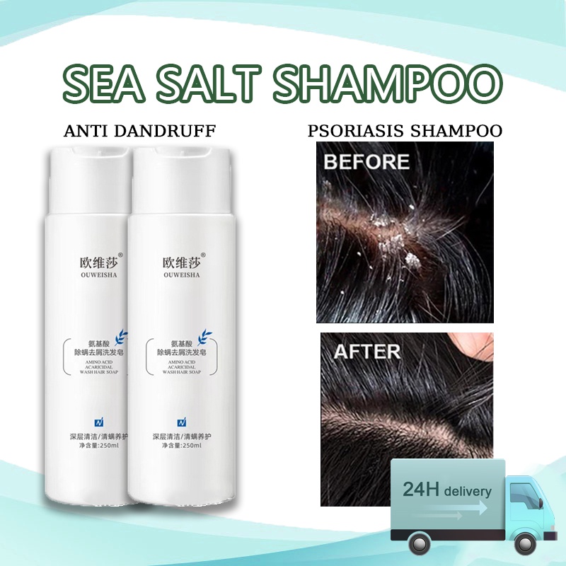 250ML Psoriasis shampoo to remove mites dandruff and itching repair