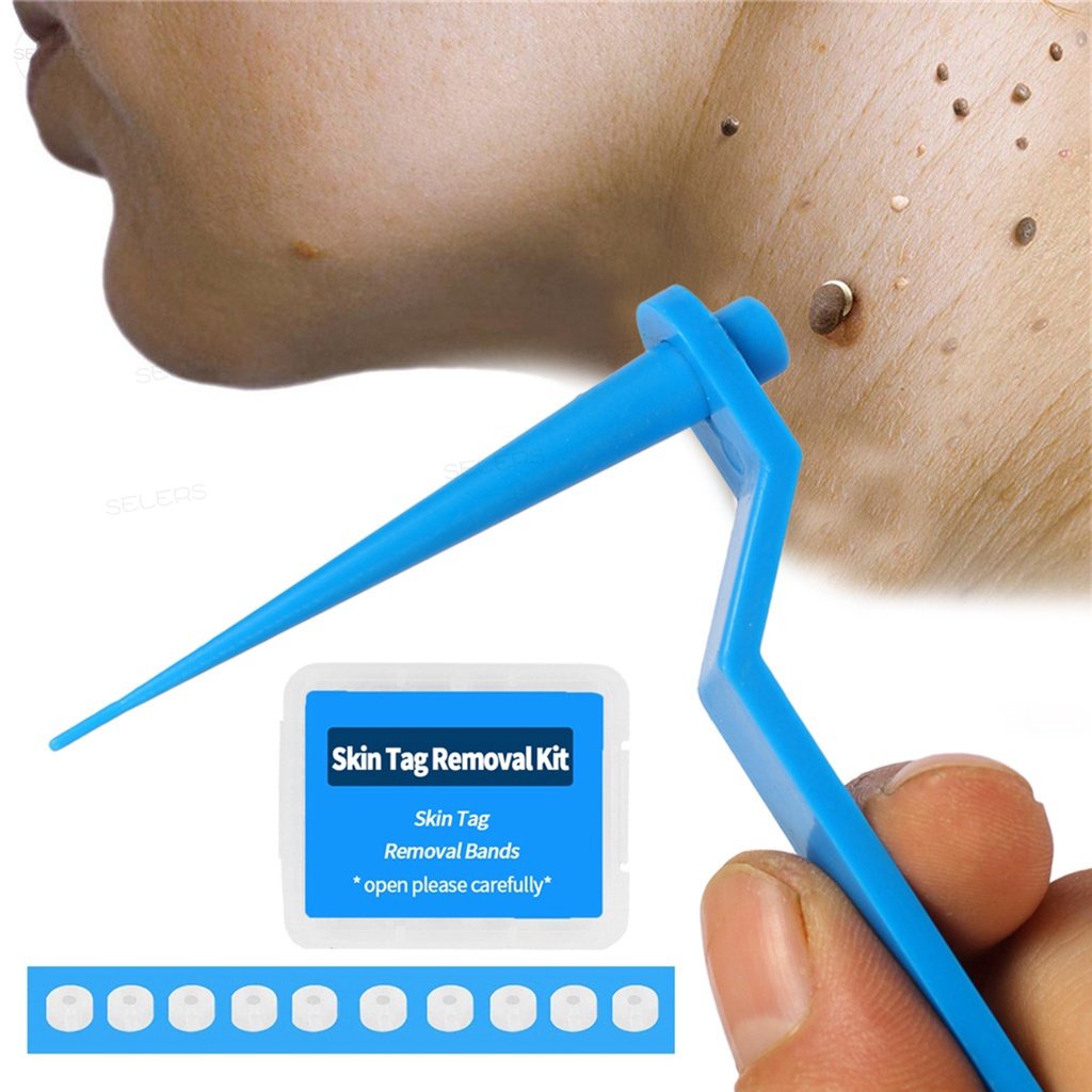 Skin Tag Remover Band Warts Removal Rubber Band Adult Mole Kulugo Remover Kit With Cleansing