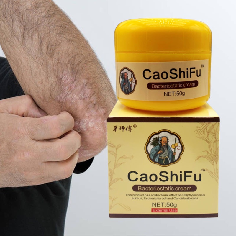 50g Caoshifu Eczema Treatment Ointment Antibacterial Psoriasis Cream Herbal Itching Skin Care 8513