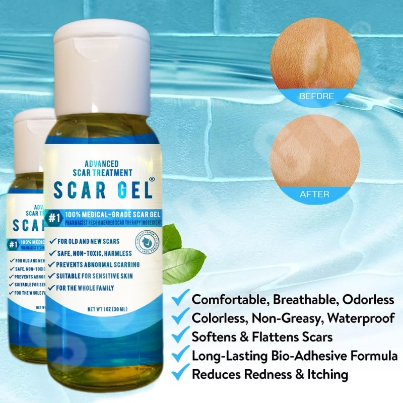 SCAR GEL By Dra. Aura Scar Treatment Stretch Marks Acne Keloids Shopee Philippines