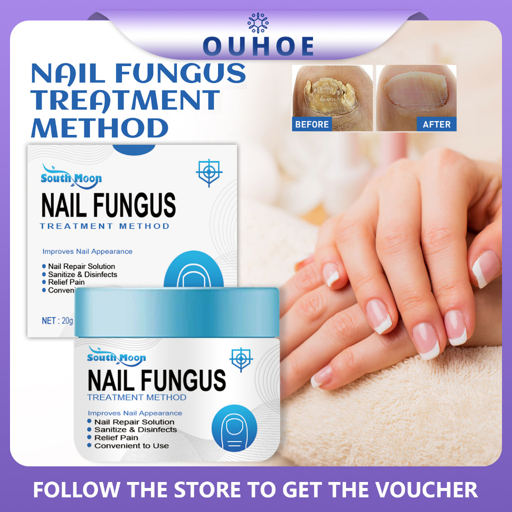 Nail Fungal Treatment Cream Anti Infection Cures Onychomycosis Toes