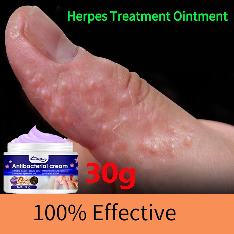Eczema Cream Antibacterial Ointment Blisters Ointment Itching Cream