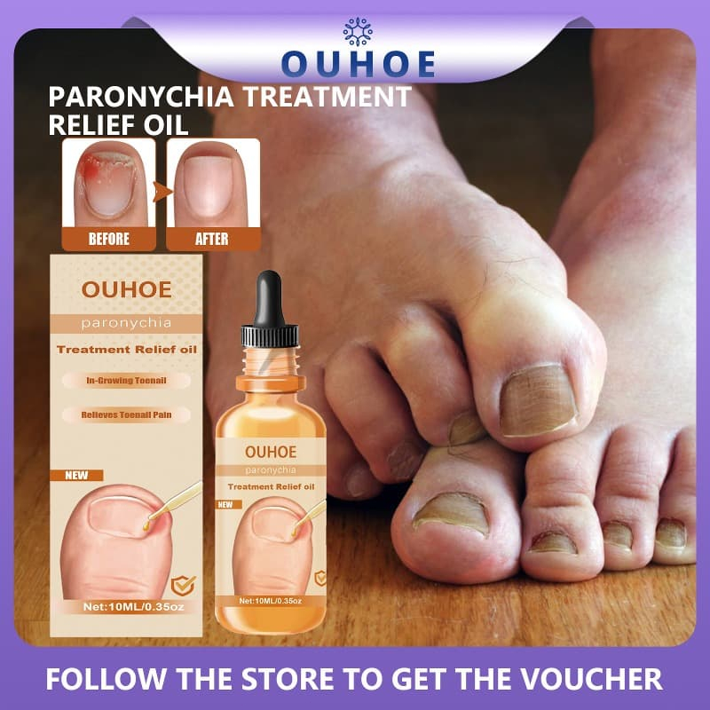 Onychomycosis Repair Serum Cure Hand Toe Paronychia AntiInfective