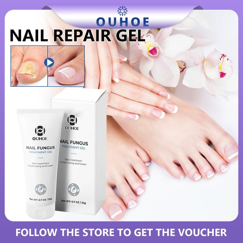OUHOE Repair Paronychia Fungus Gel Anti Infection Cure Hand Foot Toes