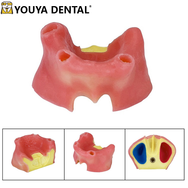 Dental Teeth Model Implant Practice Model With Soft Gums Toothless ...