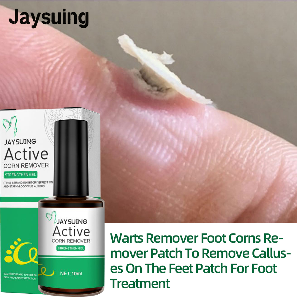 jausuing Nevus Eliminating Potion Wart Corn Removes Skin Tags Treatment Skin Warts Removal
