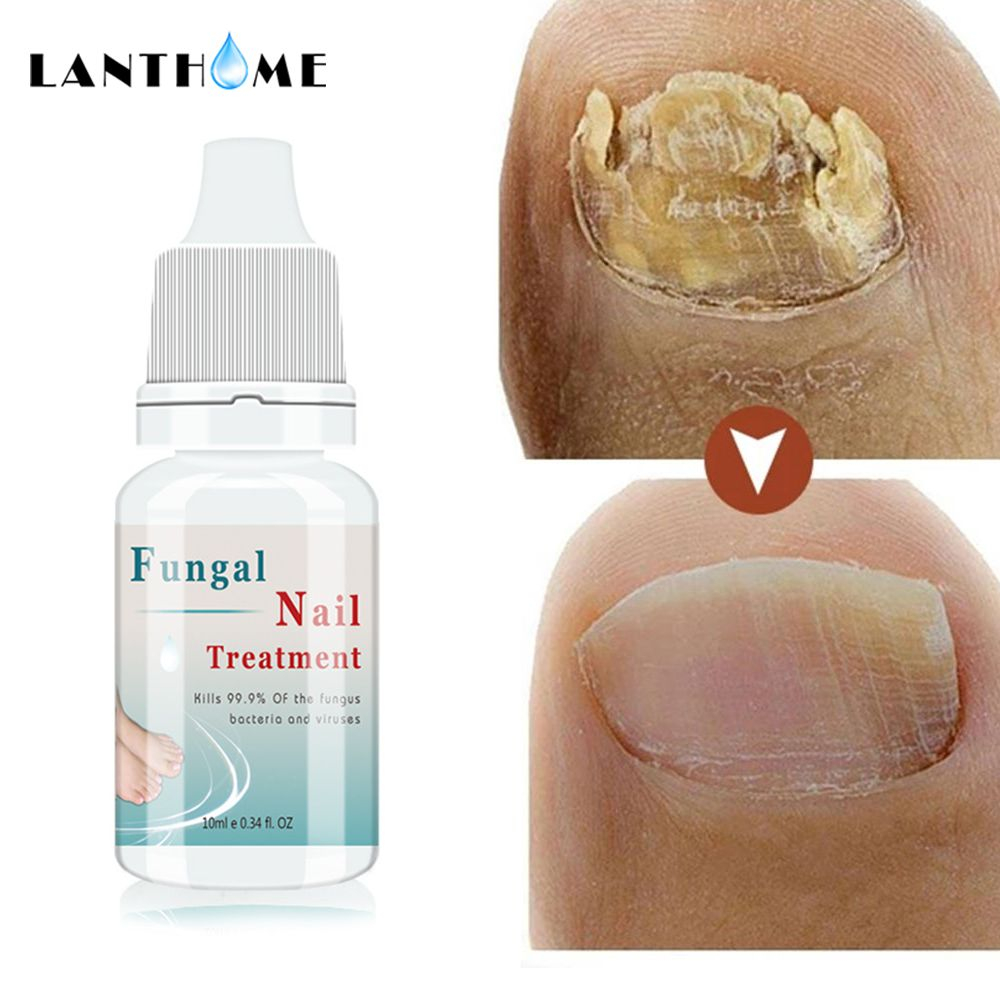 Lanthome Nail Repair Serum Essence Fungal Nail Care Removal of Onychomycosis Toe Hand Foot Skin