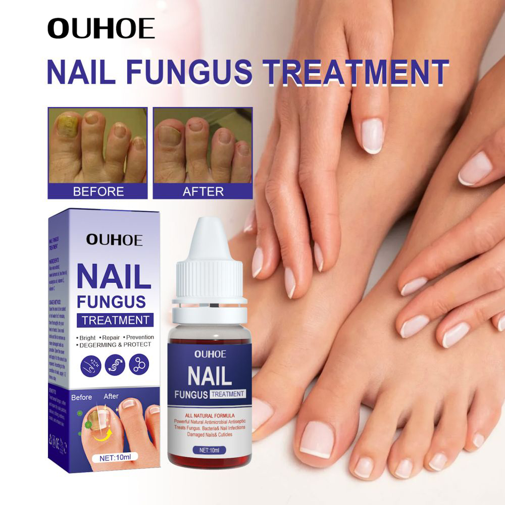 OUHOE nail treatment fungal anti fungal for nails Fungal Nail Solution
