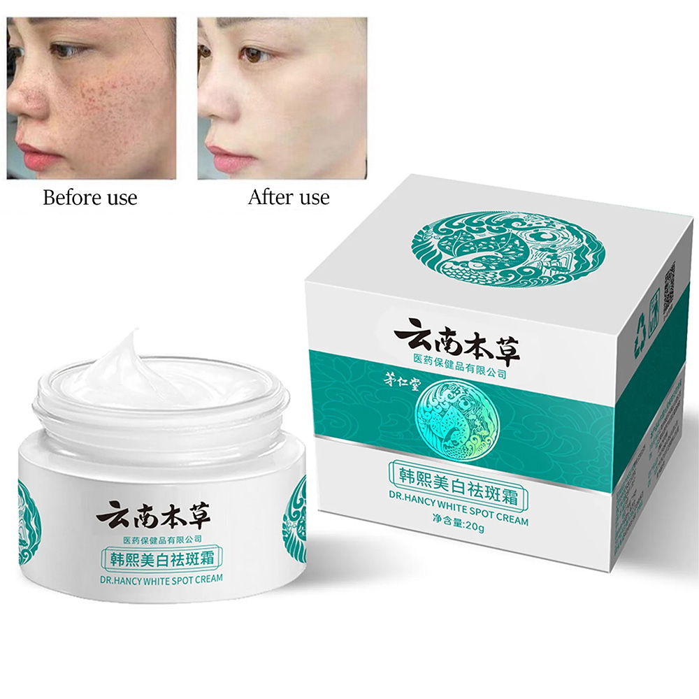 2023 HOT JAPANESE Melasma Cream White Spot Cream Skin Care Face ...