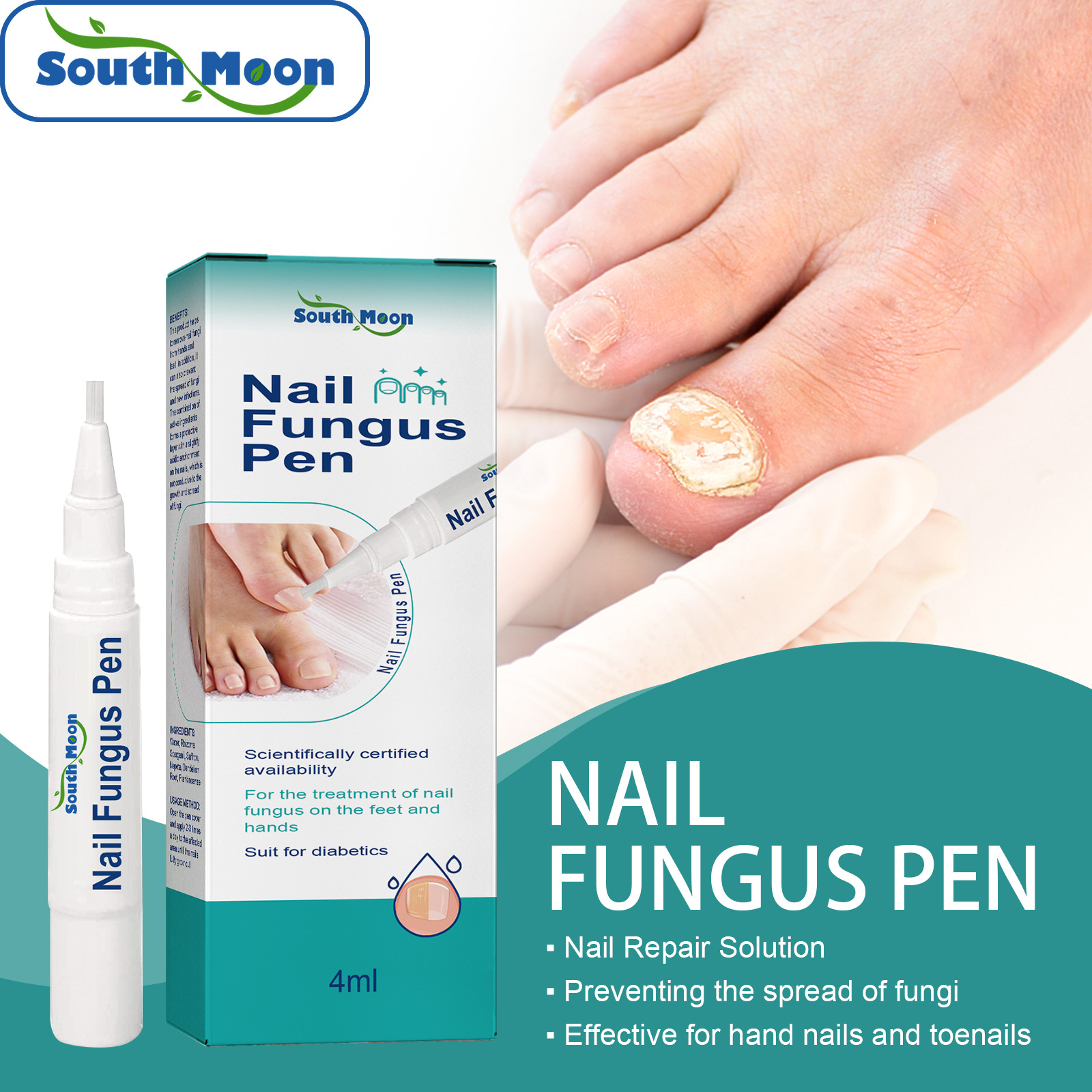 South Moon Anti Fungal Nail Infection Onychomycosis Paronychia Nail