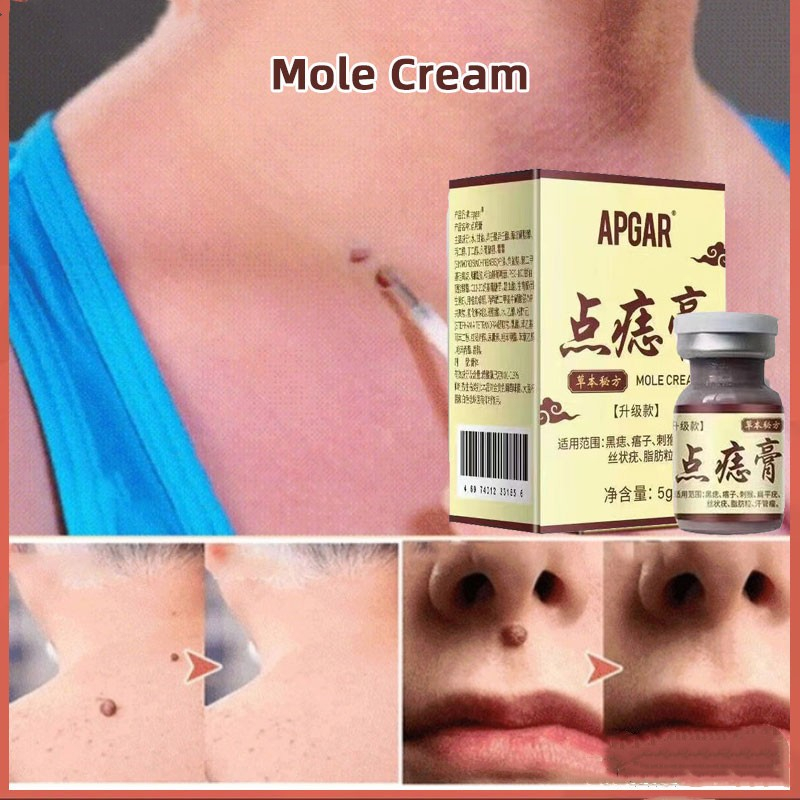 Apgar Concentrated Potent Skin Tag Removal Cream Body Warts Cream Spot Mole Ointment Shopee