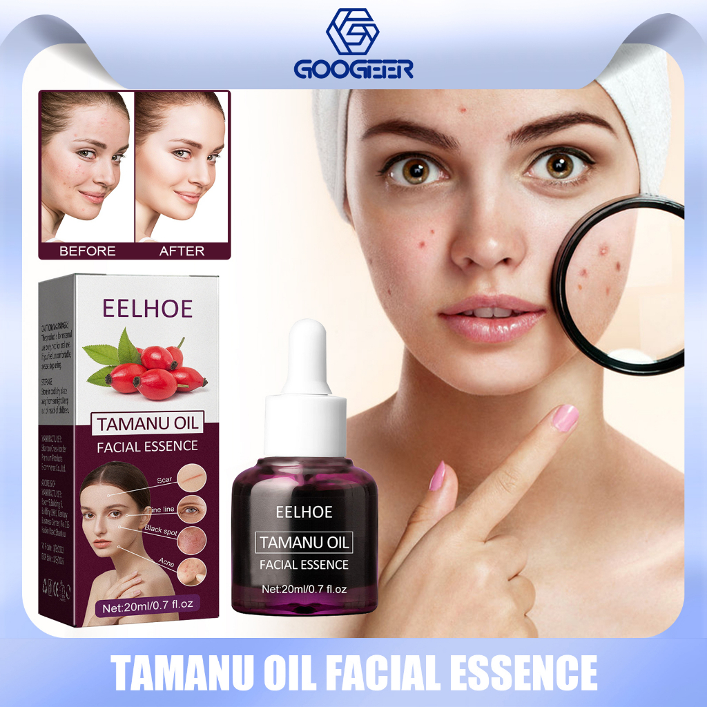 EELHOE Acne Treatment Face Serum Anti Acne Fade Spots Scars Repair Sensitive Skin Control Shrink