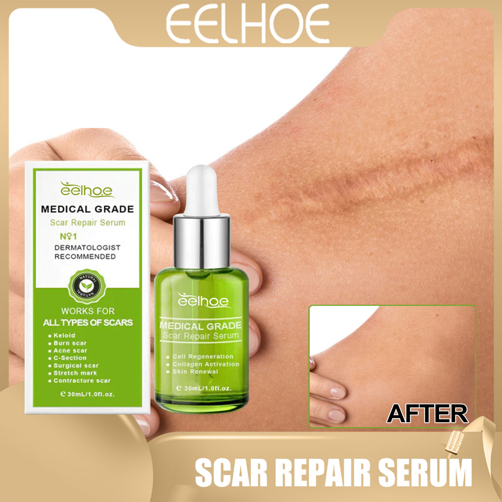 EELHOE Scar Serum Acne Scar Serum Scar Repair Cream Body Scar Serum