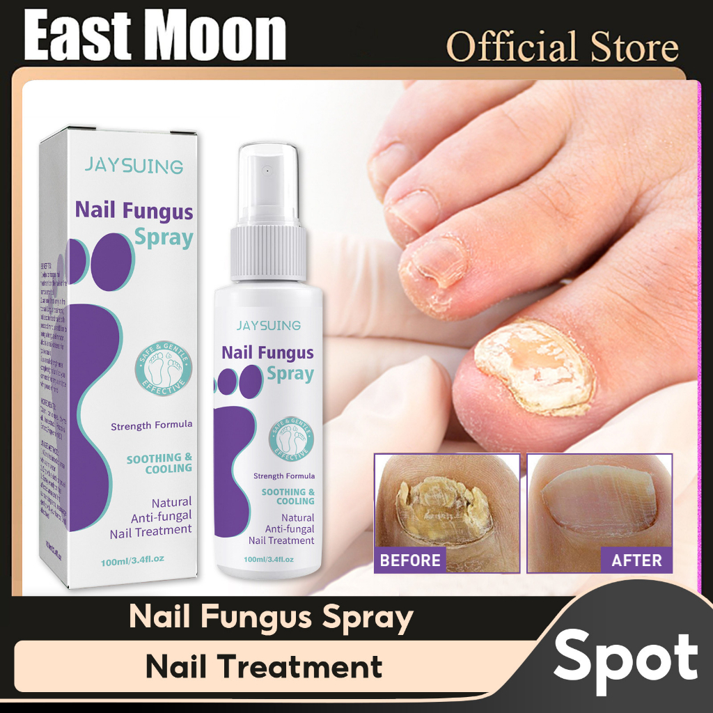 Jaysuing Nail Fungal Treatment Spray Anti Fungal Spray Ingrown Toenail