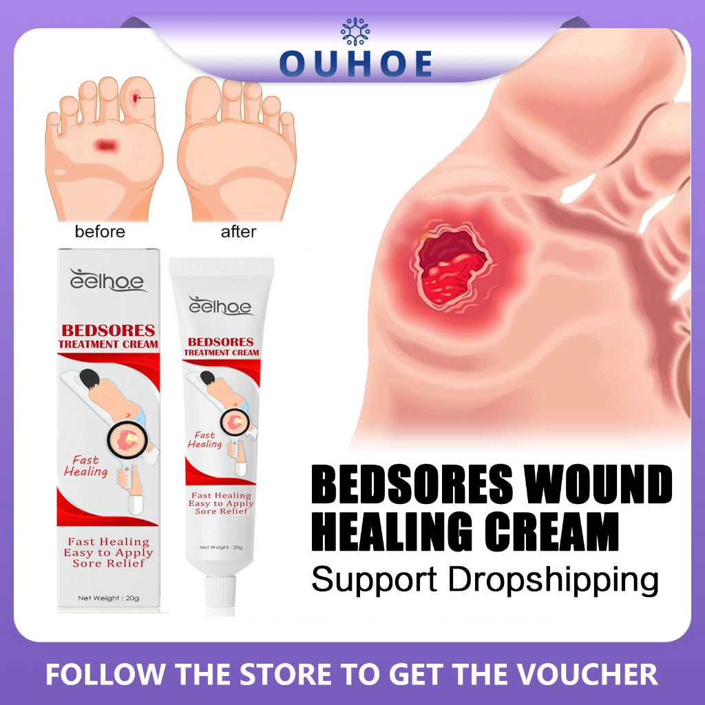 EELHOE Bedsores Wound Healing Cream Inhibit Fungal Pressure Sores Treatment Pain Festering
