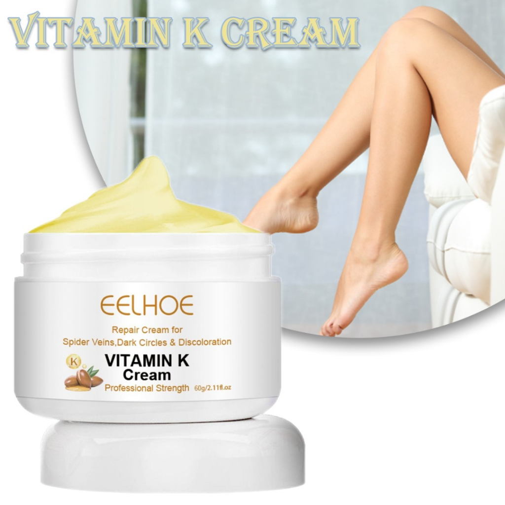 Vitamin K Cream Spider Varicose Veins for Legs Relief Dark Circles
