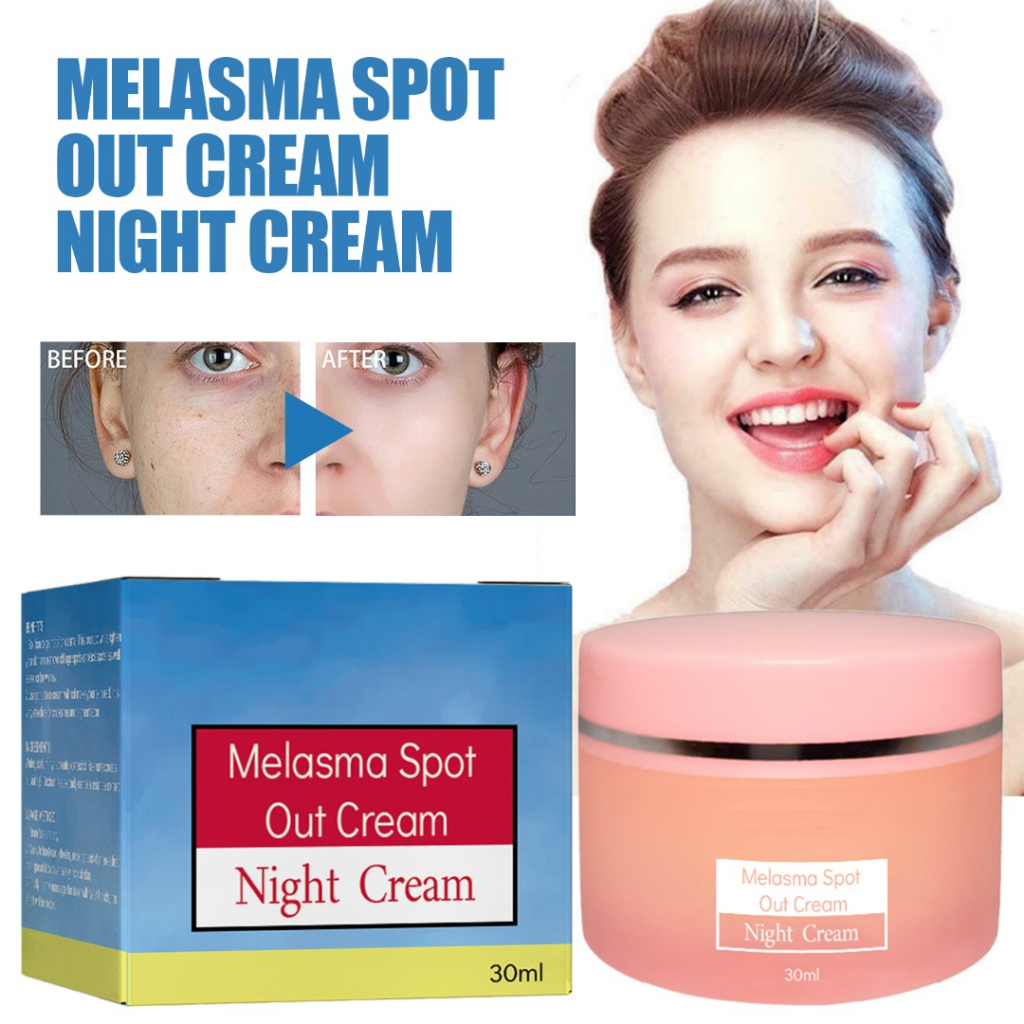 Melasma Spot Out Cream Whitening Freckle Remove Melanin Dark Spots ...