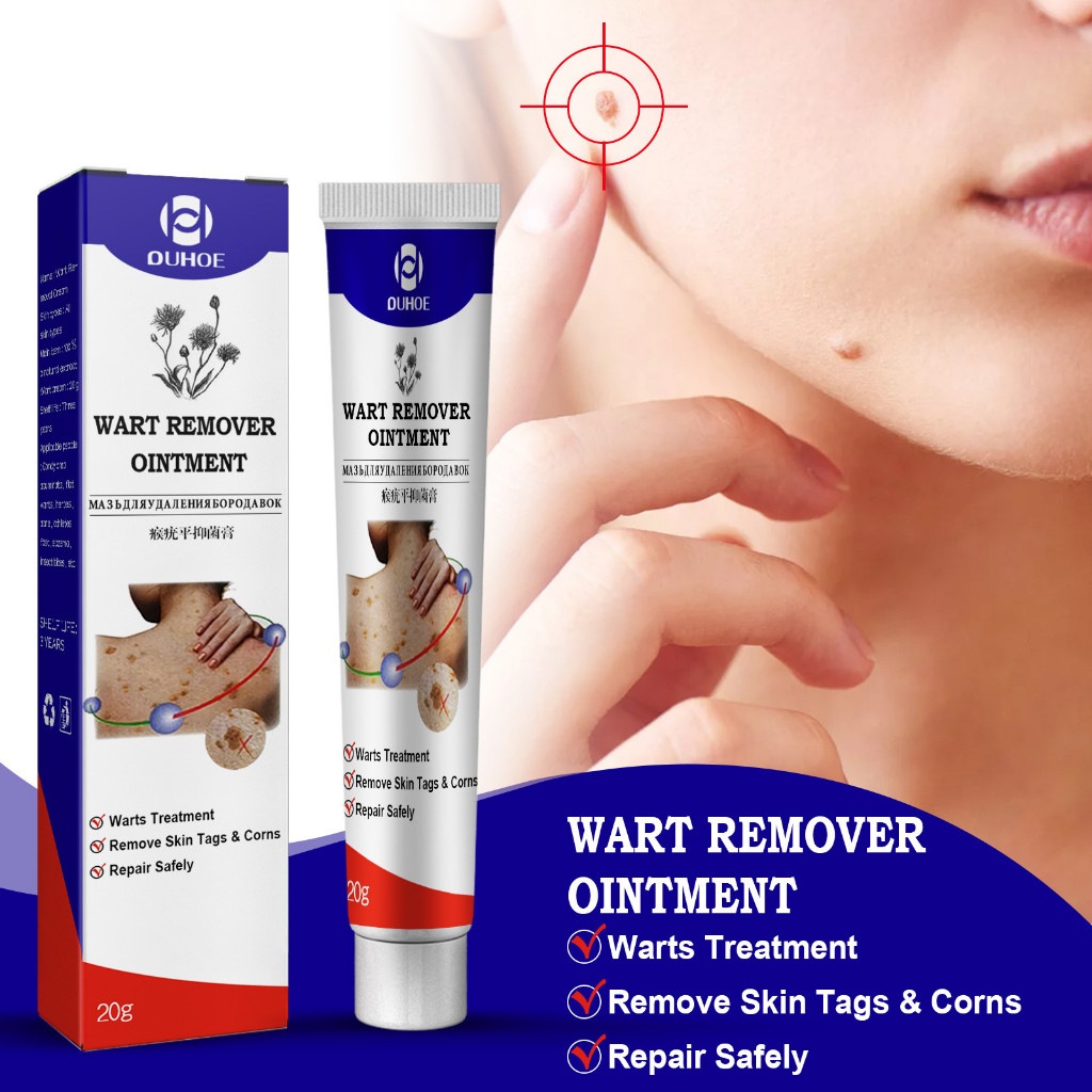 Genital Warts Remover Original Cream Condyloma Ointment Herpes Health