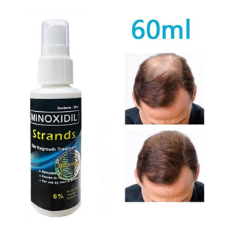 minoxidil - Best Prices and Online Promos - Jan 2024 | Shopee Philippines