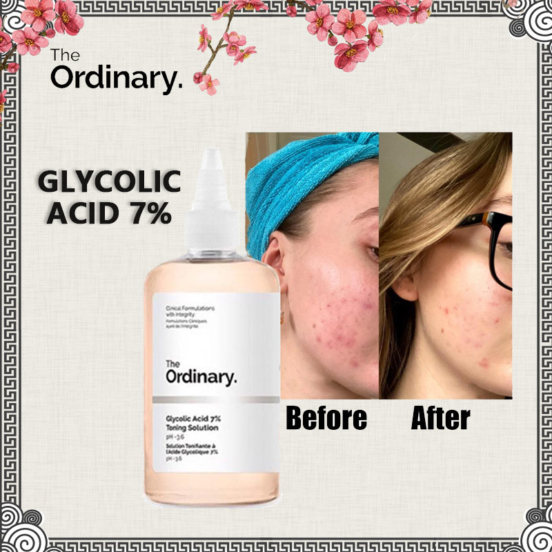 The Ordinary Glycolic Acid 7 Toning Solution 240ml Toner Facial Serum Skin Care Skincare Beauty 4450