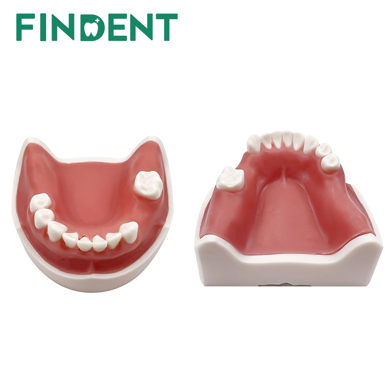1Pcs Dental Model Teeth Implant Practice Model For Dentistry Students ...
