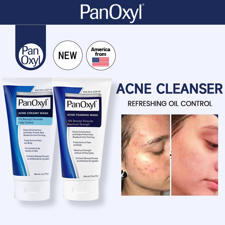 PanOxyl Benzoyl Peroxide Wash (4 Creamy or 10 Foaming)Benzonyl