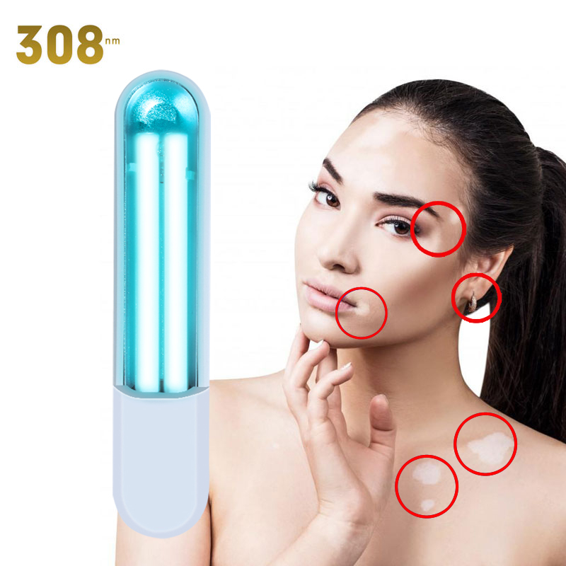Huatai 311nm uvb light for vitiligo, psoriasis, eczema, dermatitis UV