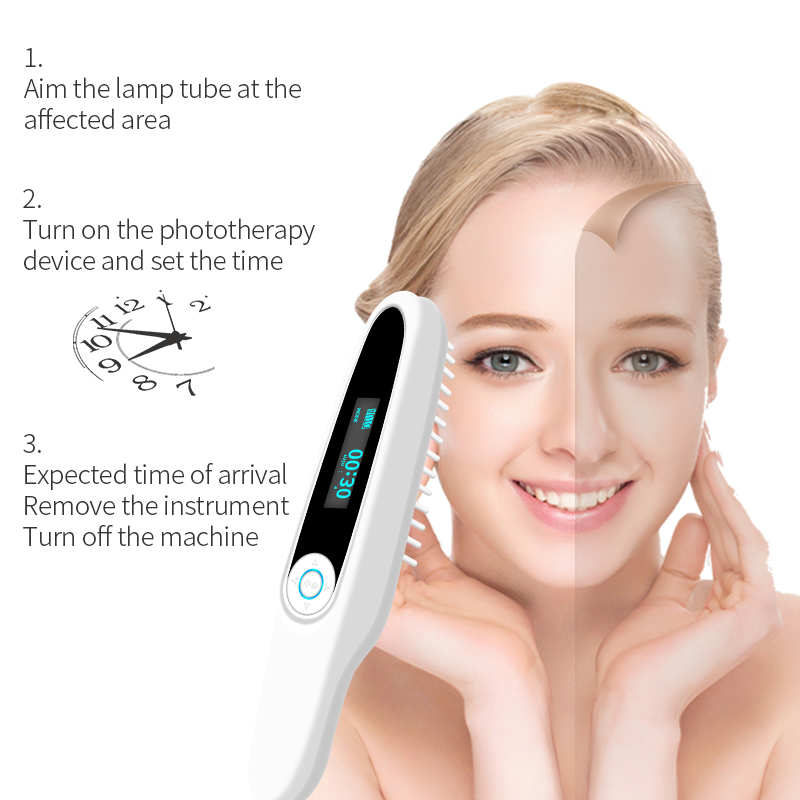 Handheld UV lamp for treatment of vitiligo light therapy instrument