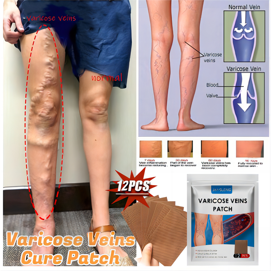 12PCS Varicose Veins Plaster Natural Varicouse Veins Patch Original