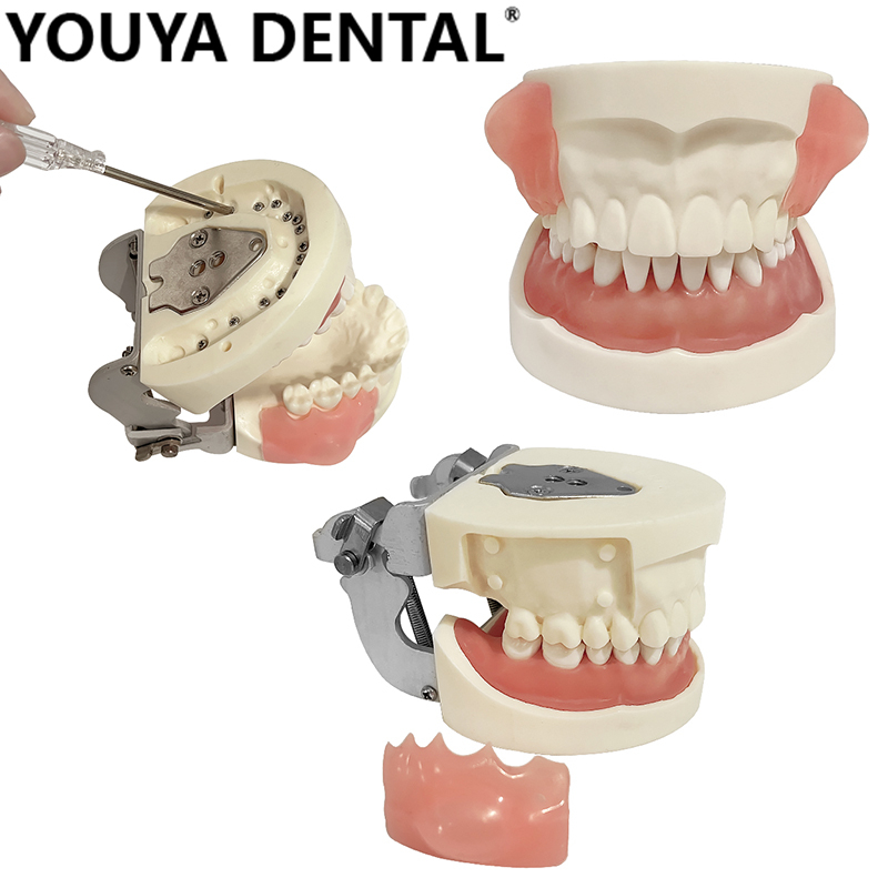 Dental Oral Cavity Teaching Model Abscess Incision Drainage Tooth Model ...