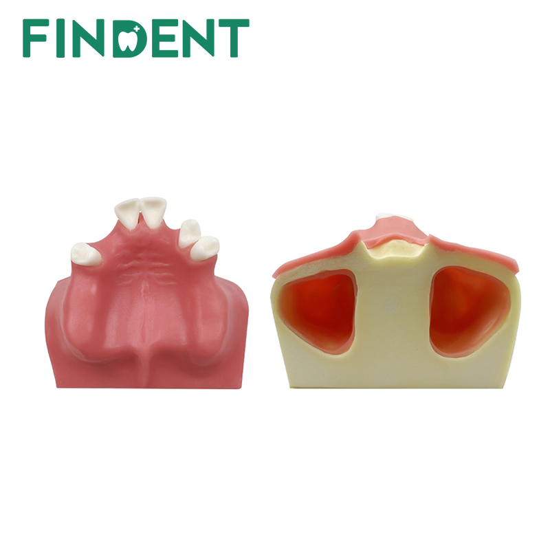 Dental Model Teeth Implant Practice Model Maxillary Sinus Teeth Model ...
