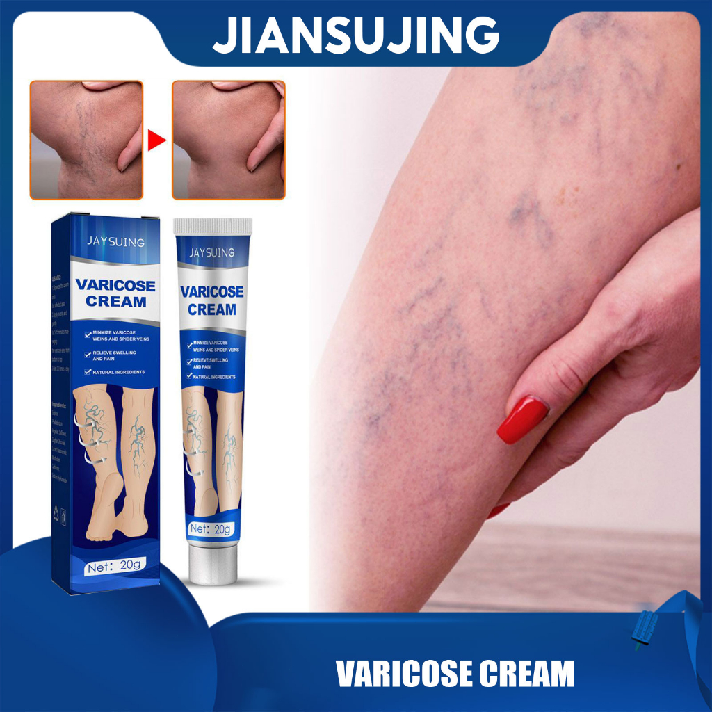 Jaysuing Varicose Vein Cream Herbal Vein Care Leg Cream Phlebitis