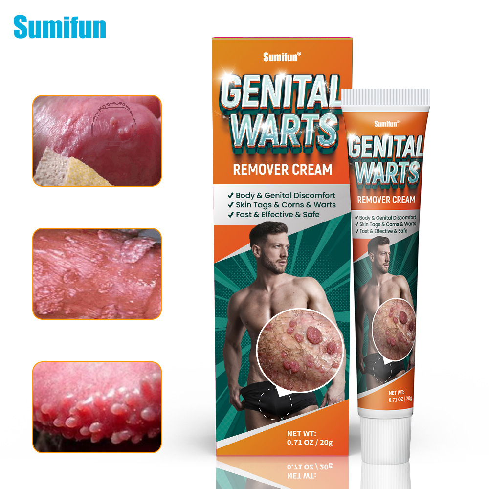 Genital Warts Remover Original Cream Genital Herpes Condyloma Skin Tag Wart Removal Ointment 2491