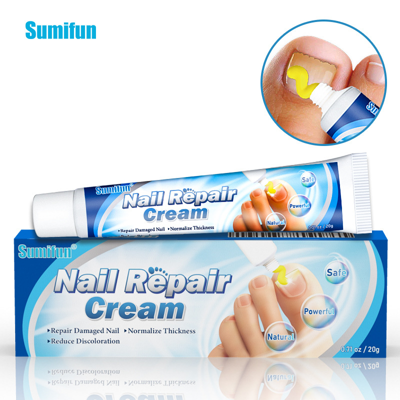 Antibacterial Cream Anti Fungal Cream Nail Fungus Treatment Paronychia ...