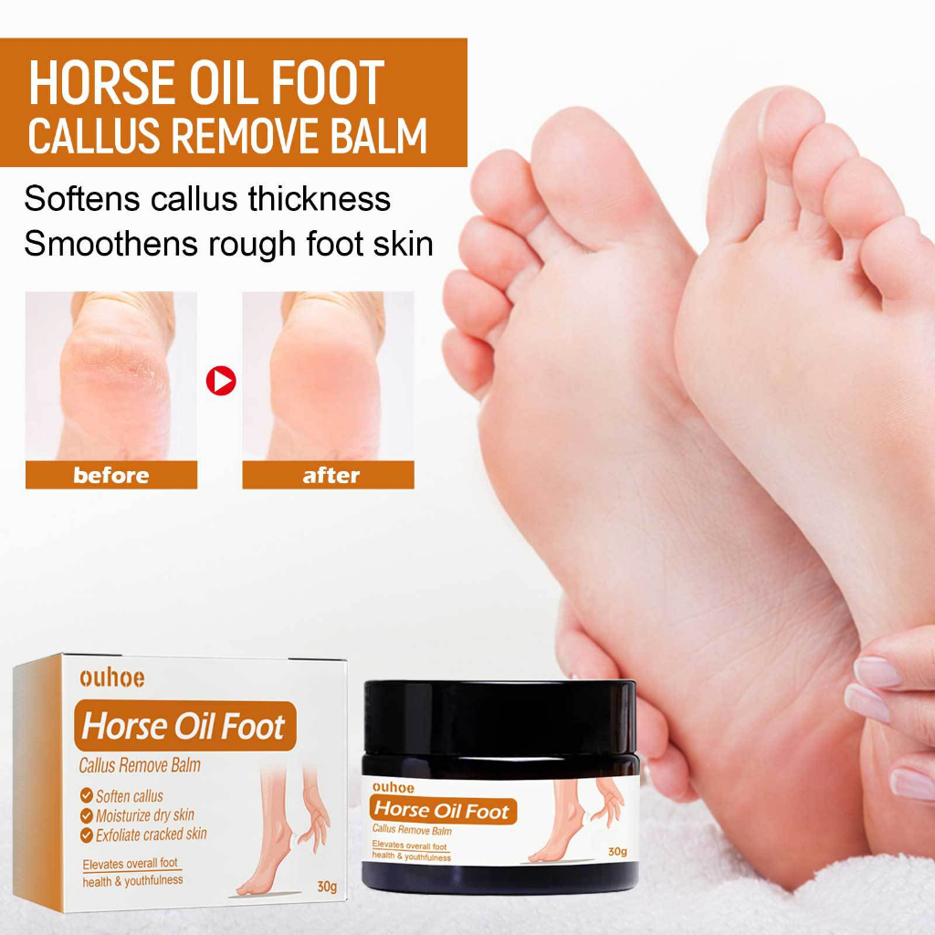 OUHOE Horse Oil Foot Callus Remove Balm Soften Callus Moisturize Dry