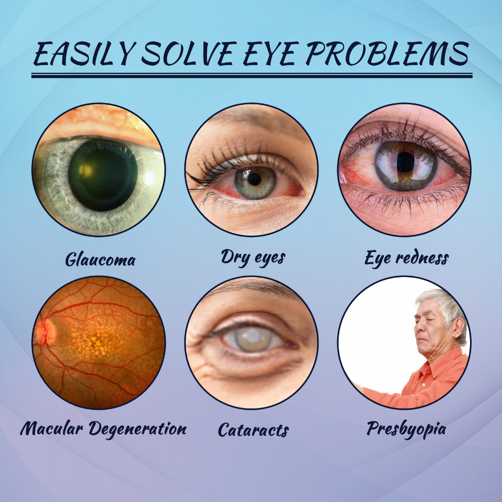 EELHOE Lubricant Eye Drops Symptom Reliever Eye Drop Liquid Dry Eye ...