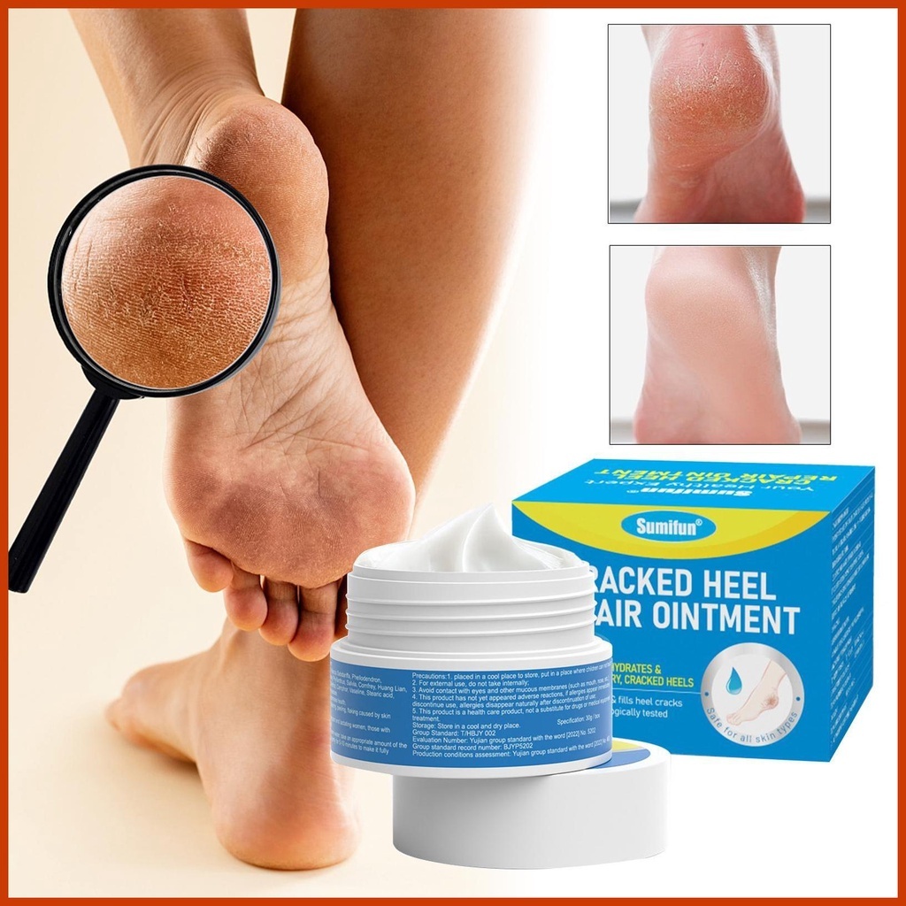 30g Herbal Antifungal Athlete's Foot Cream Treatment for Feet
