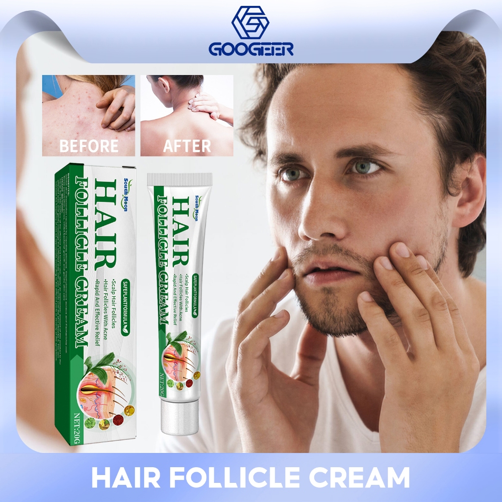 South Moon Hair Follicle Cream Scalp Cleaning Remove Hair Follicle Acne