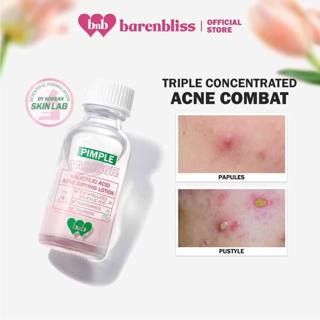 barenbliss BNB Pimple Warrior Salicylic Acid Acne Drying Lotion Triple