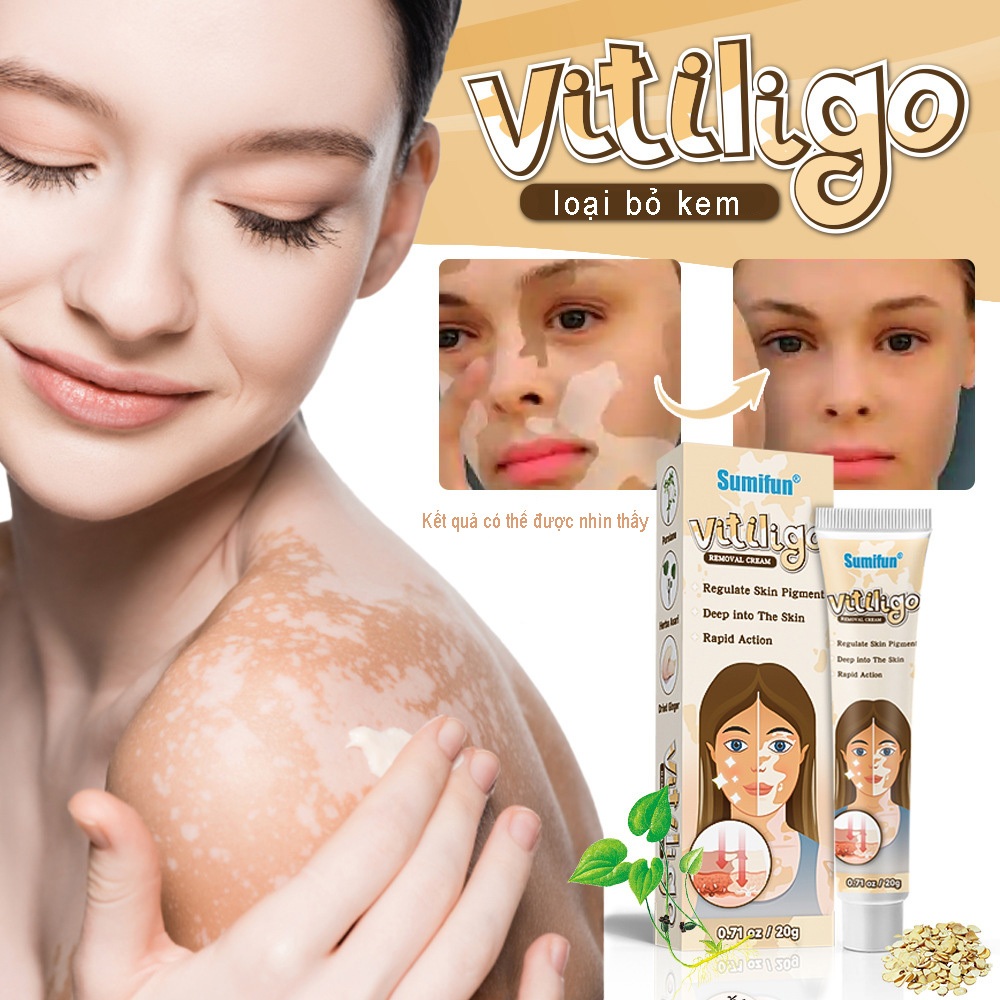 Psoriasis, sweat spots, tinea versicolor cream, tinea versicolor cream ...