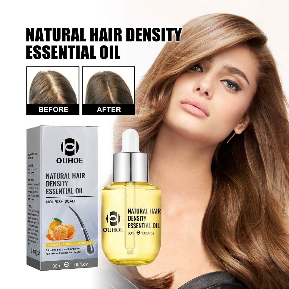 OUHOE Natural Hair Density Essential Oil Treatment Seborrheic Alopecia