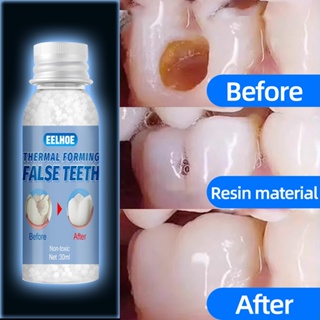 10g Resin FalseTeeth Solid Glue Temporary Tooth Repair Set Teeth And Gap  Falseteeth Solid Glue Denture Adhesive Teeth Dentist