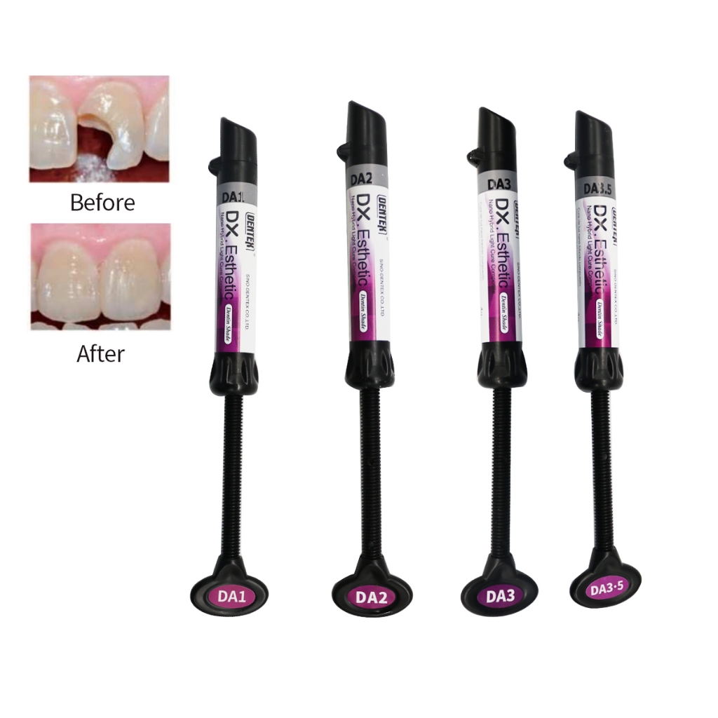 Kit Résine Composite Prime Dental Restorite Nano Hybrid – Photopolymérisable, Livraison Gratuite