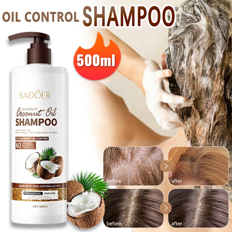 Coconut Shampoo Anti-Dandruff Repair Damage Hair Dry Hair Care Control ...